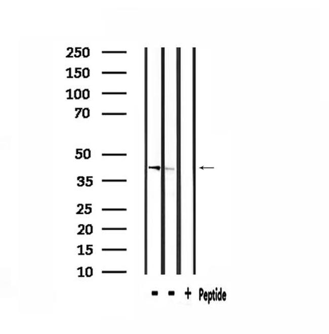 ARRDC3 Antibody in Western Blot (WB)