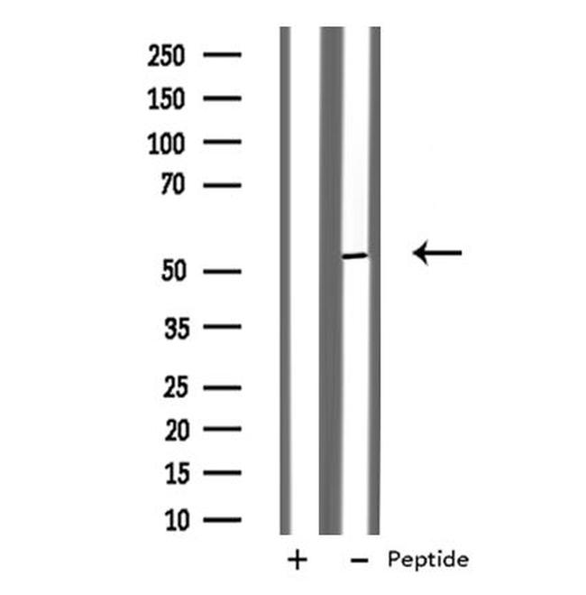 CADM1 Antibody in Western Blot (WB)