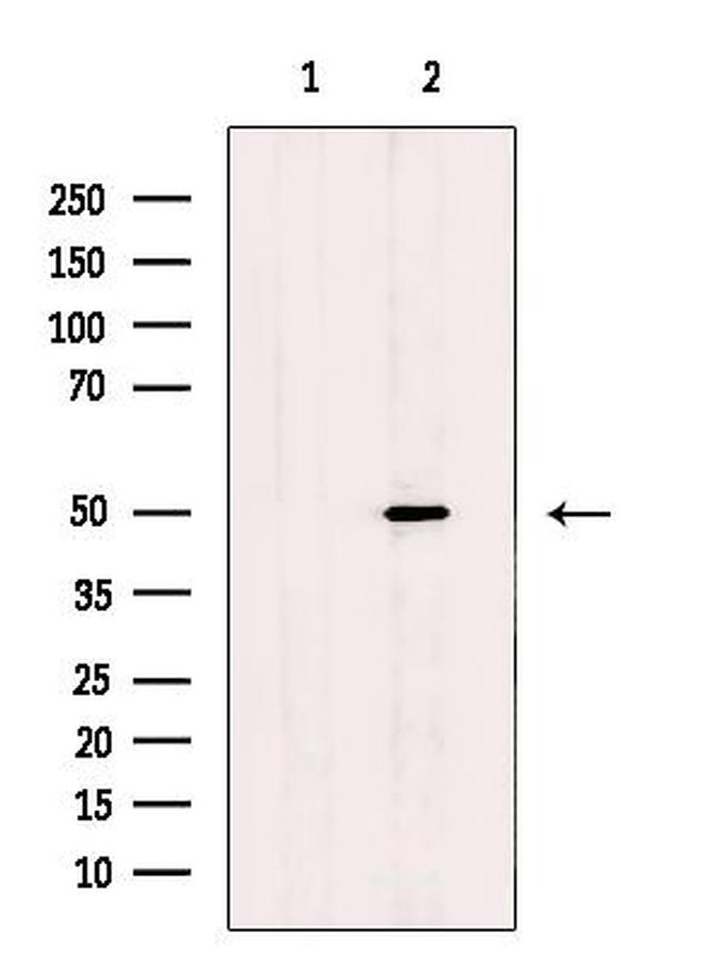 CADM1 Antibody in Western Blot (WB)