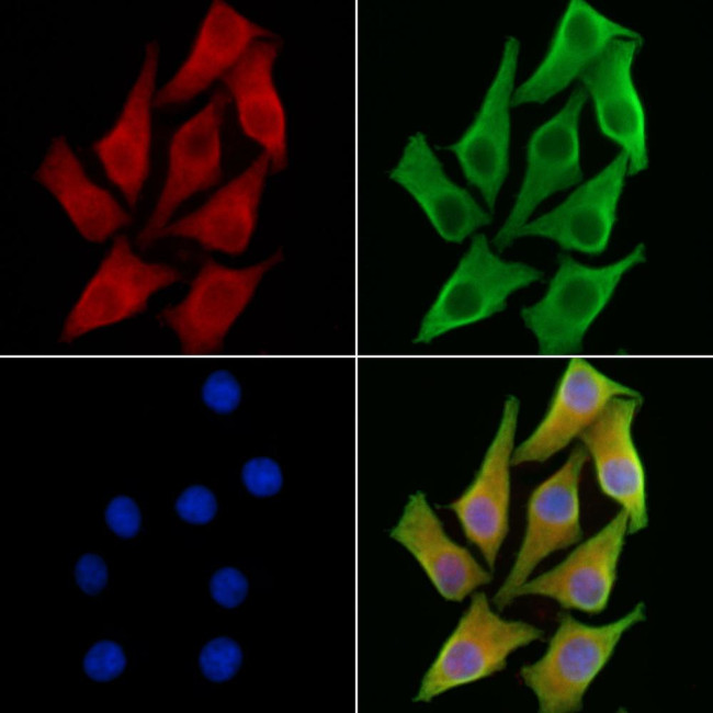 HCCS Antibody in Immunocytochemistry (ICC/IF)