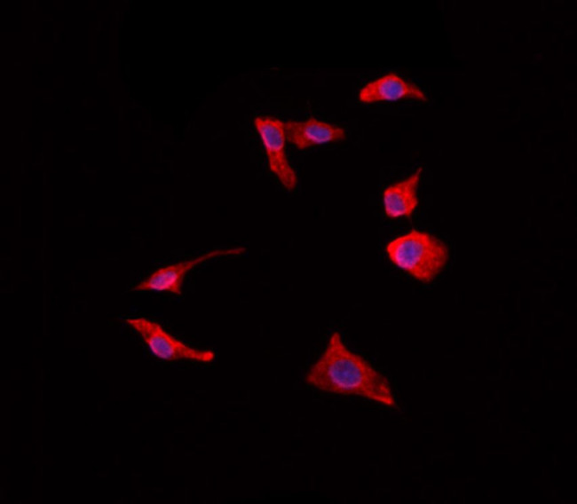 CCR11 Antibody in Immunocytochemistry (ICC/IF)