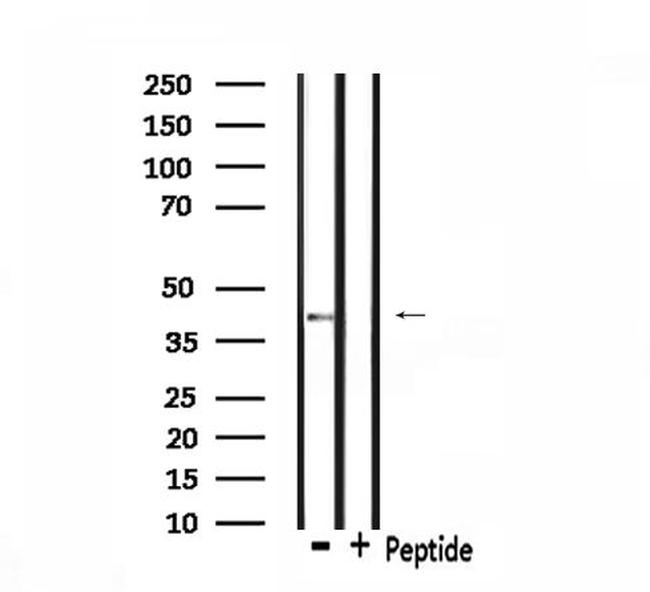 CCR11 Antibody in Western Blot (WB)