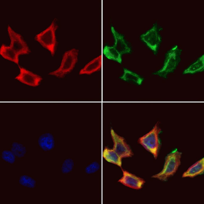 CDKAL1 Antibody in Immunocytochemistry (ICC/IF)