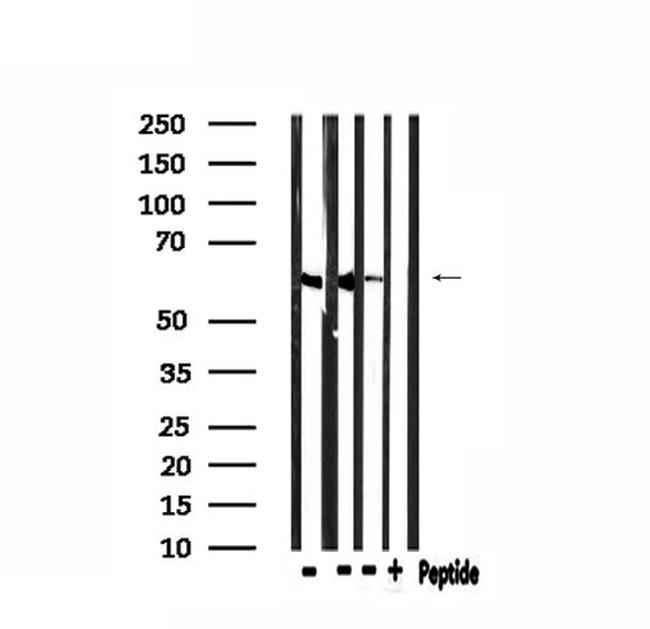 CDKAL1 Antibody in Western Blot (WB)