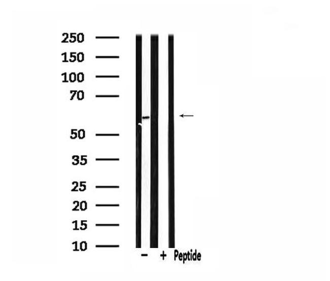 CDKAL1 Antibody in Western Blot (WB)