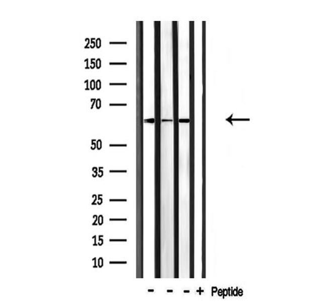 CDKAL1 Antibody in Western Blot (WB)