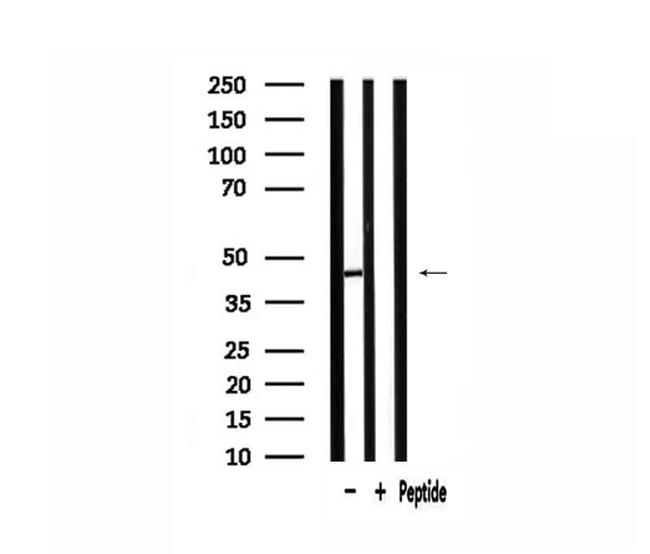 AGPAT5 Antibody in Western Blot (WB)