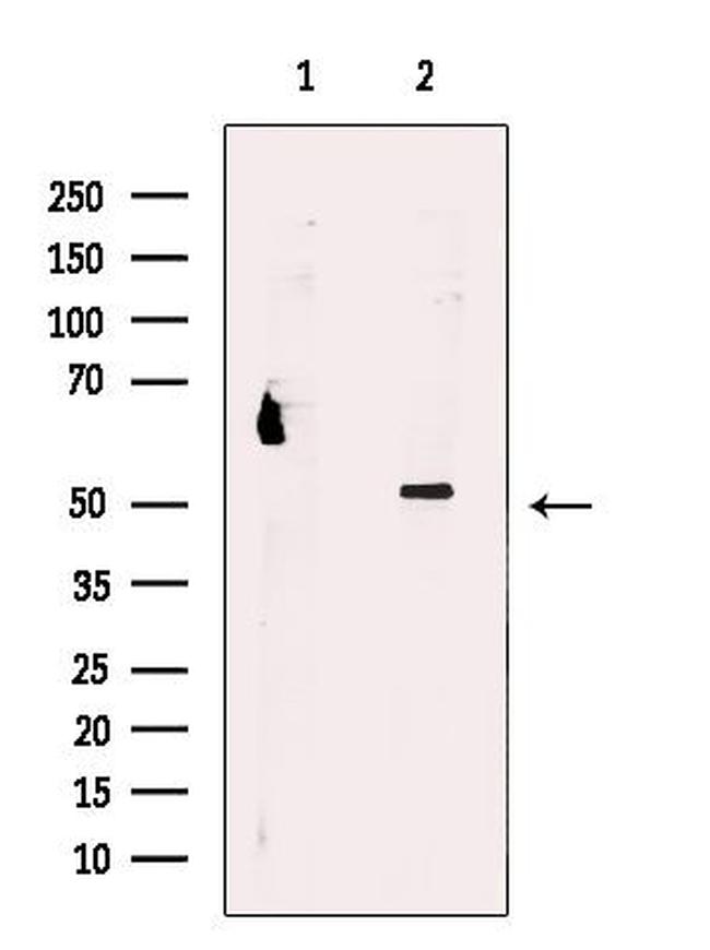 PSMD12 Antibody in Western Blot (WB)