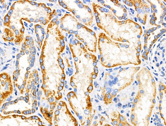 MRPL11 Antibody in Immunohistochemistry (Paraffin) (IHC (P))