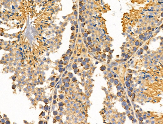 MRPL11 Antibody in Immunohistochemistry (Paraffin) (IHC (P))