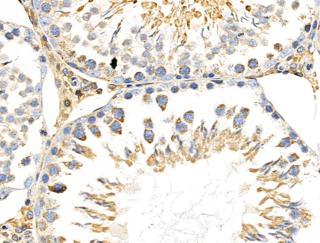 MRPL11 Antibody in Immunohistochemistry (Paraffin) (IHC (P))