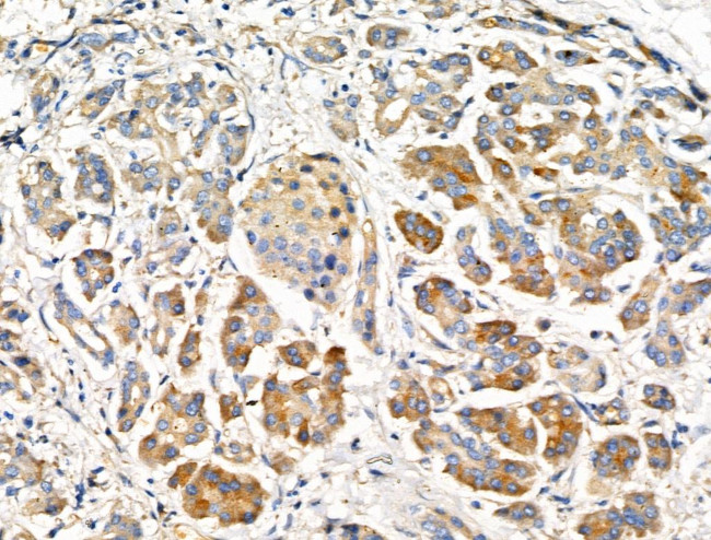 MRPL44 Antibody in Immunohistochemistry (Paraffin) (IHC (P))