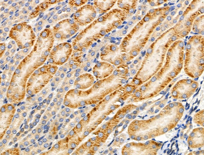 MRPL44 Antibody in Immunohistochemistry (Paraffin) (IHC (P))