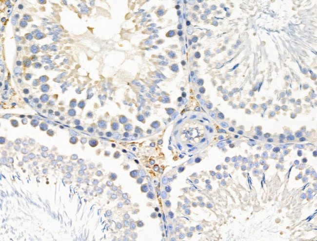 MRPL44 Antibody in Immunohistochemistry (Paraffin) (IHC (P))