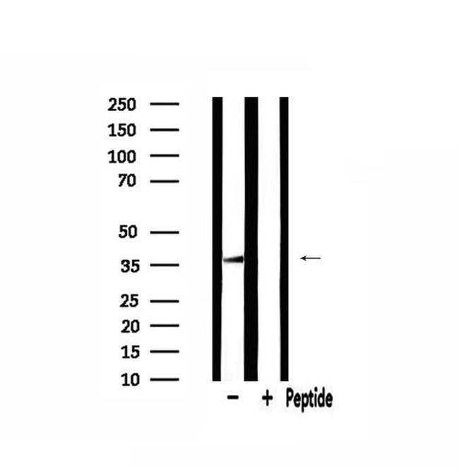 MRPL44 Antibody in Western Blot (WB)