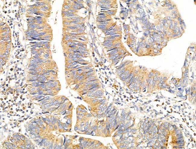 RPS18 Antibody in Immunohistochemistry (Paraffin) (IHC (P))