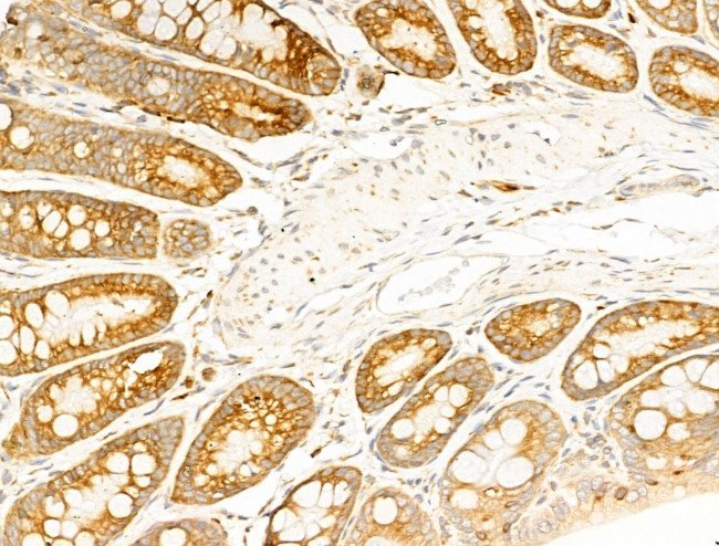 RPS18 Antibody in Immunohistochemistry (Paraffin) (IHC (P))