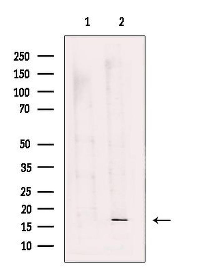 RPS18 Antibody in Western Blot (WB)