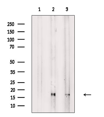 RPS18 Antibody in Western Blot (WB)