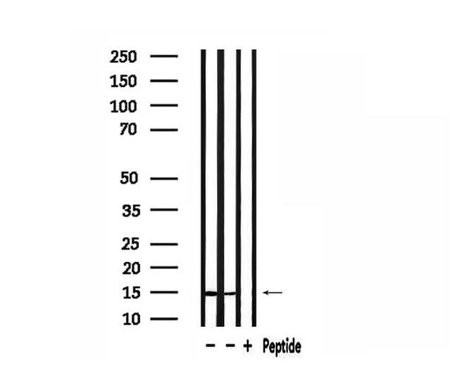 RPS19 Antibody in Western Blot (WB)