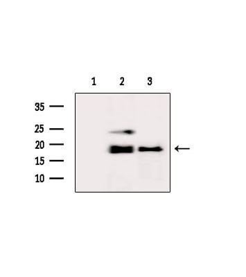 RPS19 Antibody in Western Blot (WB)