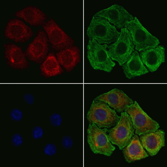 RPL17 Antibody in Immunocytochemistry (ICC/IF)