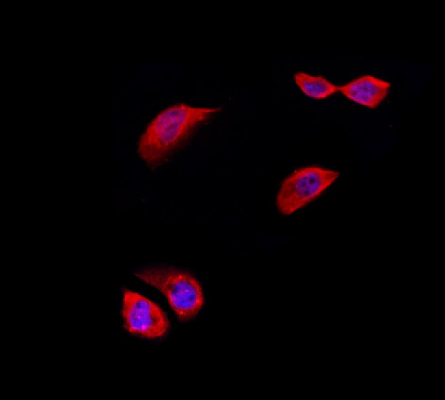 RPL5 Antibody in Immunocytochemistry (ICC/IF)