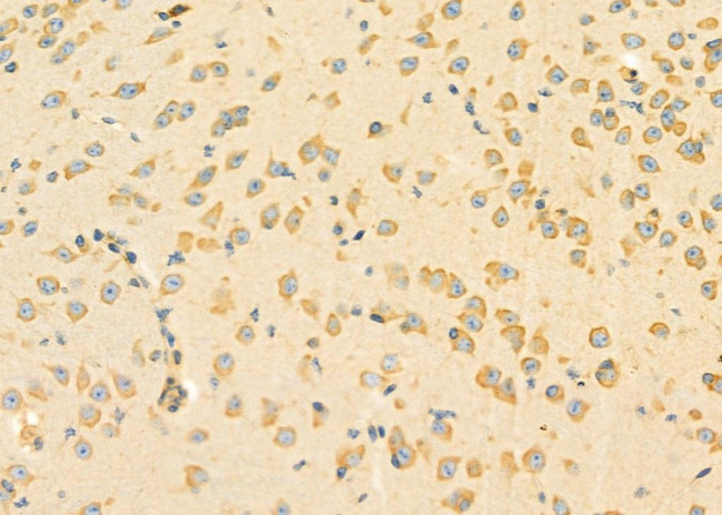 RPL5 Antibody in Immunohistochemistry (Paraffin) (IHC (P))