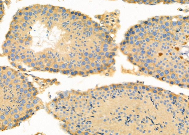 RPL5 Antibody in Immunohistochemistry (Paraffin) (IHC (P))