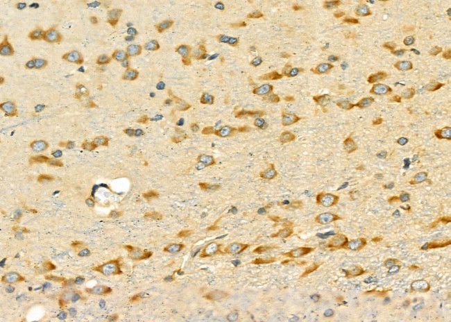 RPL5 Antibody in Immunohistochemistry (Paraffin) (IHC (P))