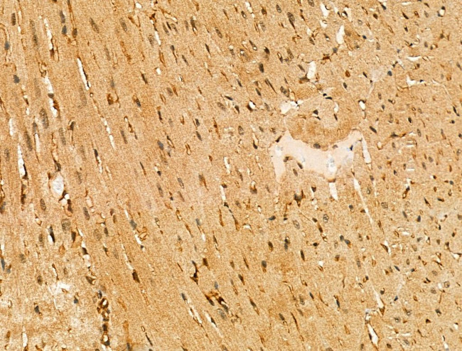 ABHD2 Antibody in Immunohistochemistry (Paraffin) (IHC (P))