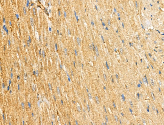 ABHD2 Antibody in Immunohistochemistry (Paraffin) (IHC (P))