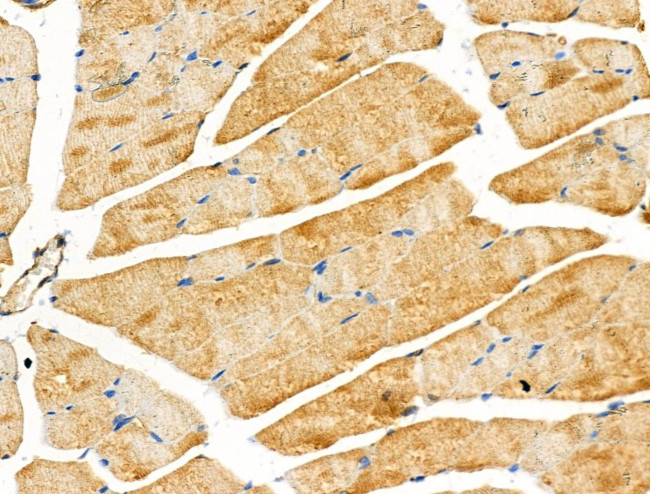 ABHD2 Antibody in Immunohistochemistry (Paraffin) (IHC (P))