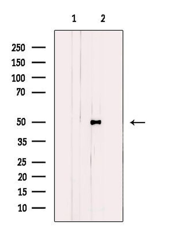 ABHD2 Antibody in Western Blot (WB)