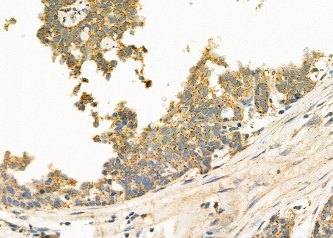 ABHD7 Antibody in Immunohistochemistry (Paraffin) (IHC (P))