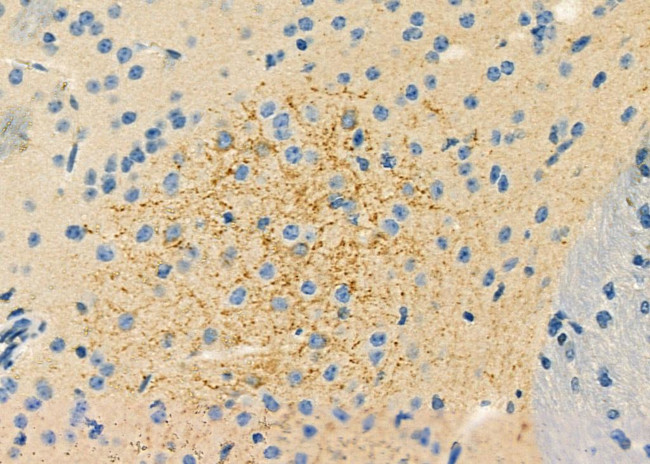 ABHD7 Antibody in Immunohistochemistry (Paraffin) (IHC (P))