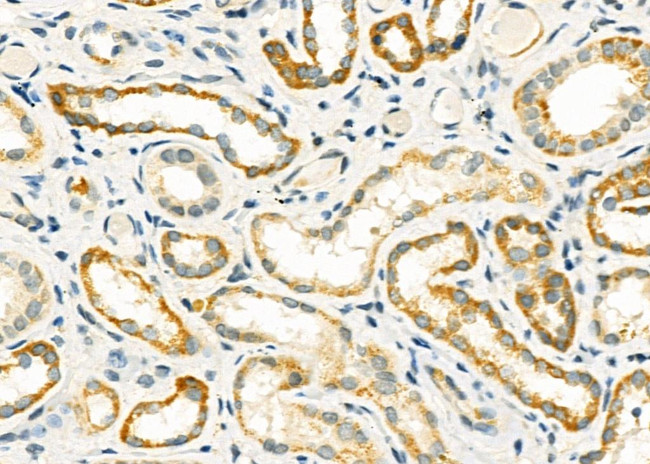 ABHD7 Antibody in Immunohistochemistry (Paraffin) (IHC (P))