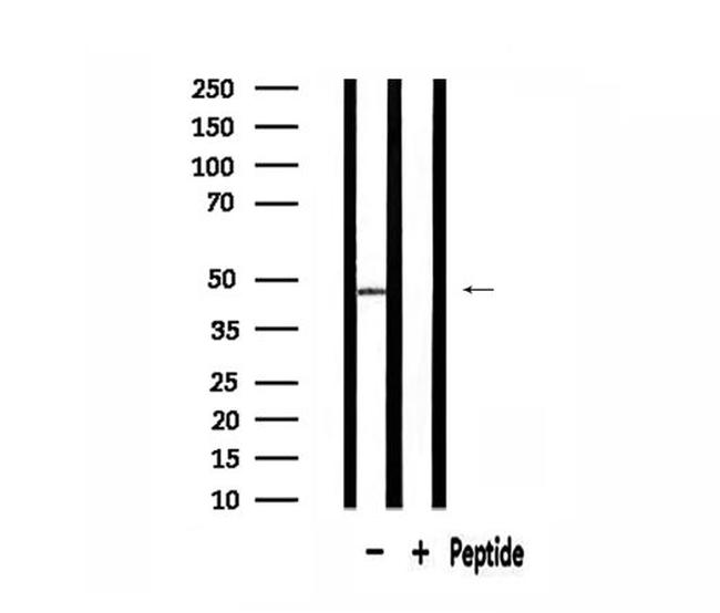 ABHD8 Antibody in Western Blot (WB)