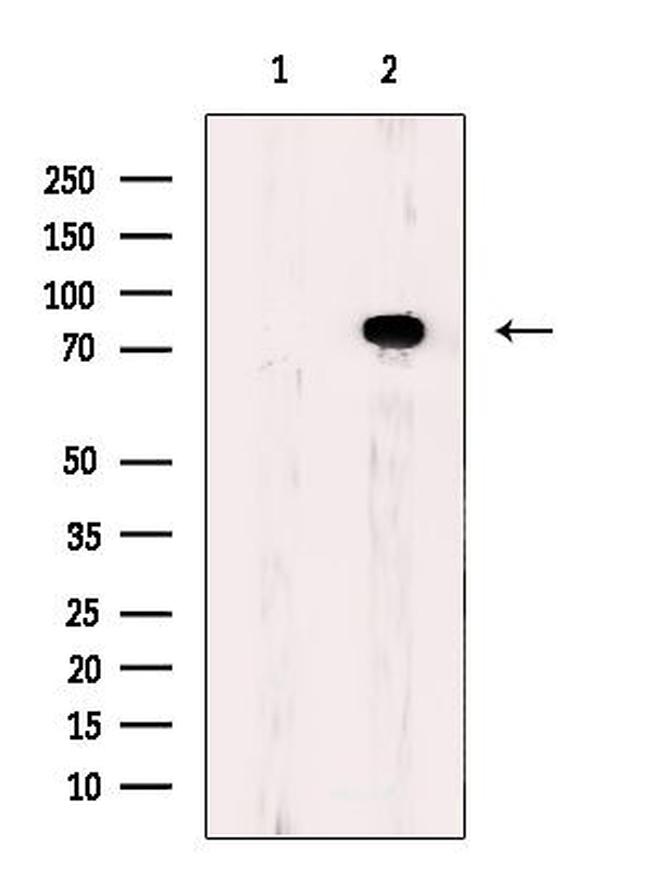 ACSS2 Antibody in Western Blot (WB)