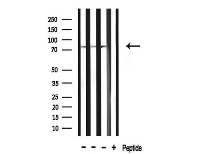 ACSS2 Antibody in Western Blot (WB)