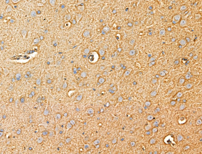 ACOT4 Antibody in Immunohistochemistry (Paraffin) (IHC (P))