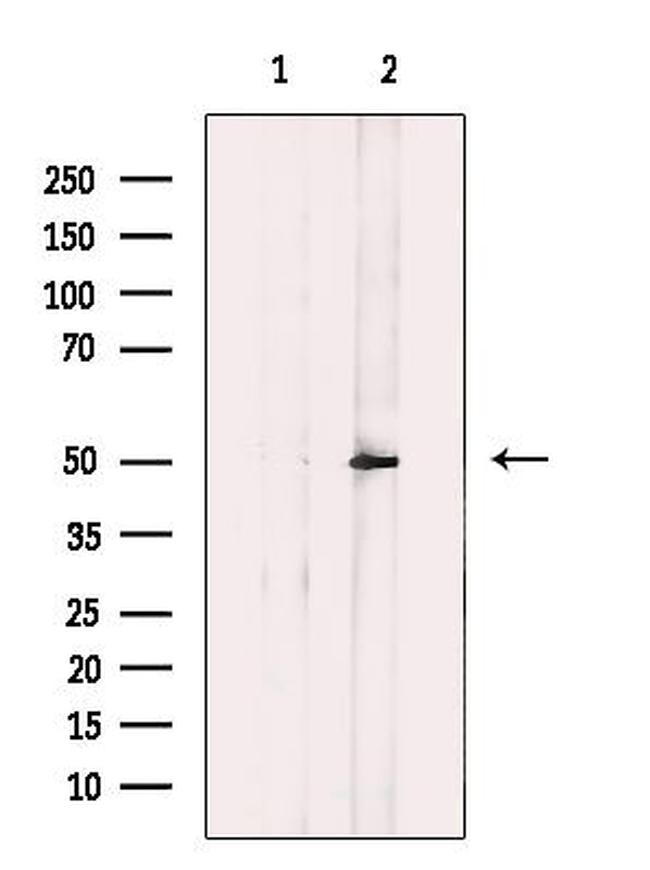 ACOT4 Antibody in Western Blot (WB)