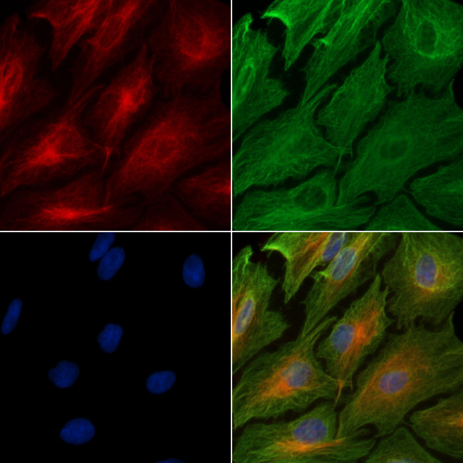 ADAM32 Antibody in Immunocytochemistry (ICC/IF)