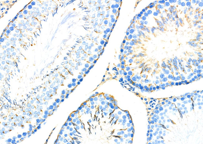 ADAM32 Antibody in Immunohistochemistry (Paraffin) (IHC (P))