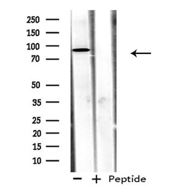 ADAM32 Antibody in Western Blot (WB)