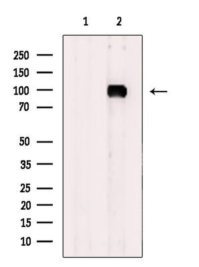 ADAM32 Antibody in Western Blot (WB)