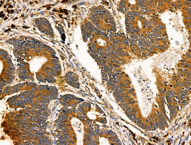 ADAMTS19 Antibody in Immunohistochemistry (Paraffin) (IHC (P))