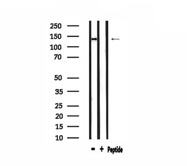 ADAMTS19 Antibody in Western Blot (WB)