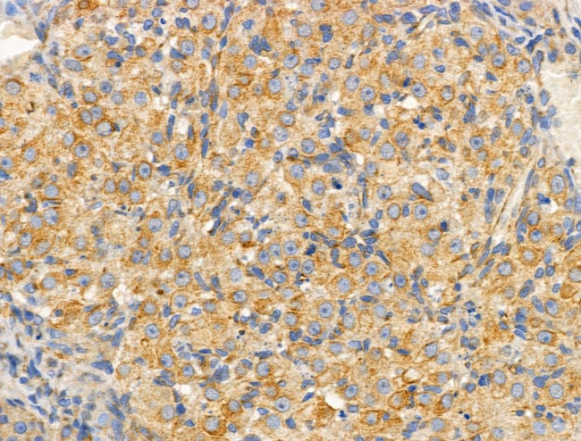 SLC25A6 Antibody in Immunohistochemistry (Paraffin) (IHC (P))