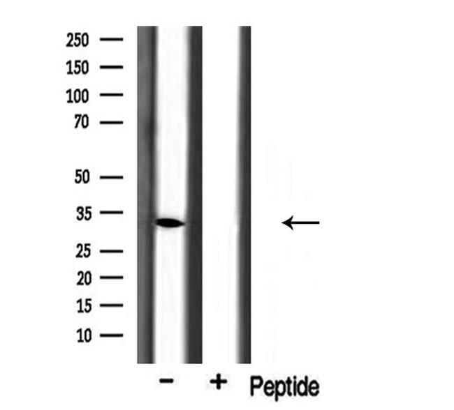 BST-1 Antibody in Western Blot (WB)